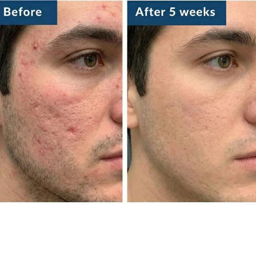 Dermaura GHK-Cu Repair